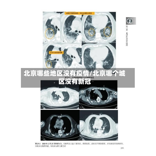 北京哪些地区没有疫情/北京哪个城区没有新冠